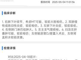 求教下，各位老师，下一步是否需要做术前新辅助