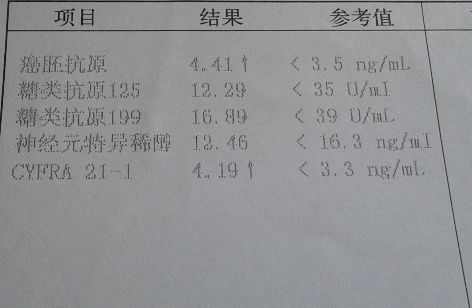 盲试特一个月后的报告