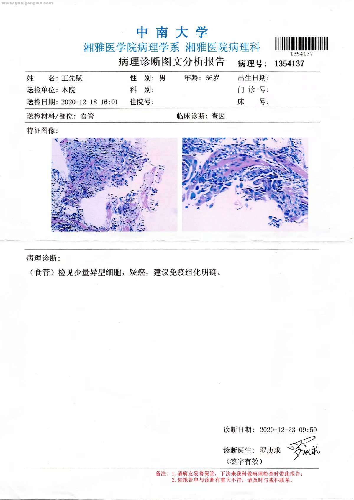 湘雅复查（食管病理报告）.jpg