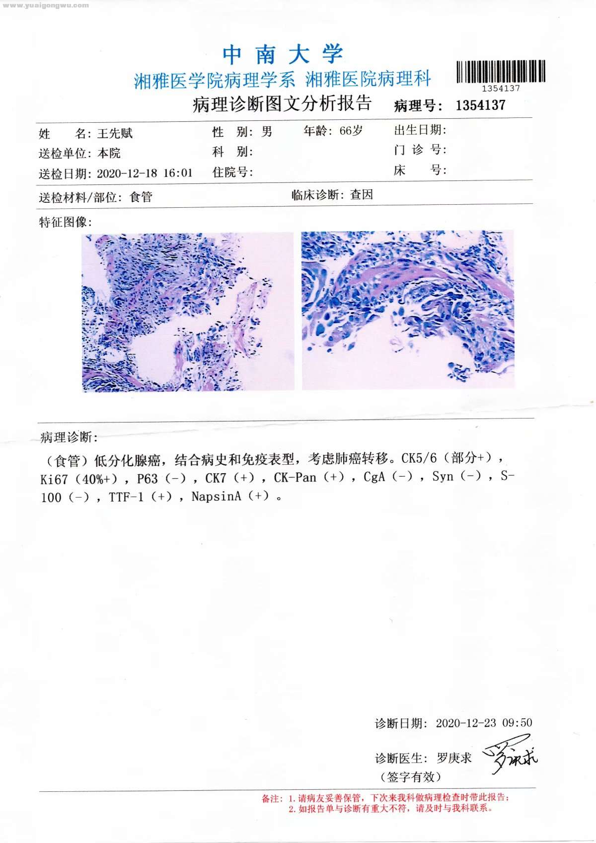 湘雅复查（食管病理免疫组化）.jpg